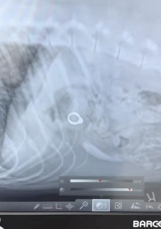 Illustration de l'article : Incapable de retrouver sa bague de fiançailles, elle suspecte son chien et l'emmène chez le vétérinaire pour en avoir le cœur net 