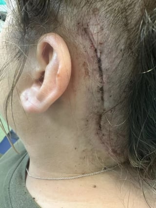 Illustration de l'article : "Je pense qu'elle m'a sauvé la vie", une chienne révèle par accident le mal dont une jeune femme souffrait