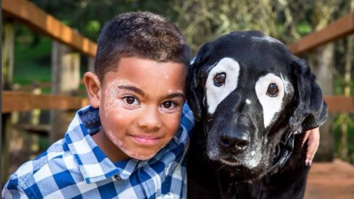 Illustration : "Tous les deux atteints de vitiligo, ce chien aide son humain à accepter la maladie ! "