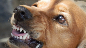Illustration : Les personnes souffrant d’anxiété sont davantage exposées aux morsures de chiens