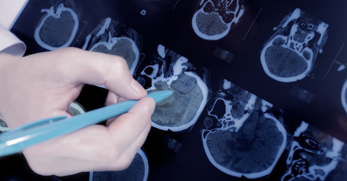 Reconnaitre Et Soigner La Crise D Epilepsie Chez Votre Chat Reconnaitre Et Soigner La Crise D Epilepsie Chez Votre Chat