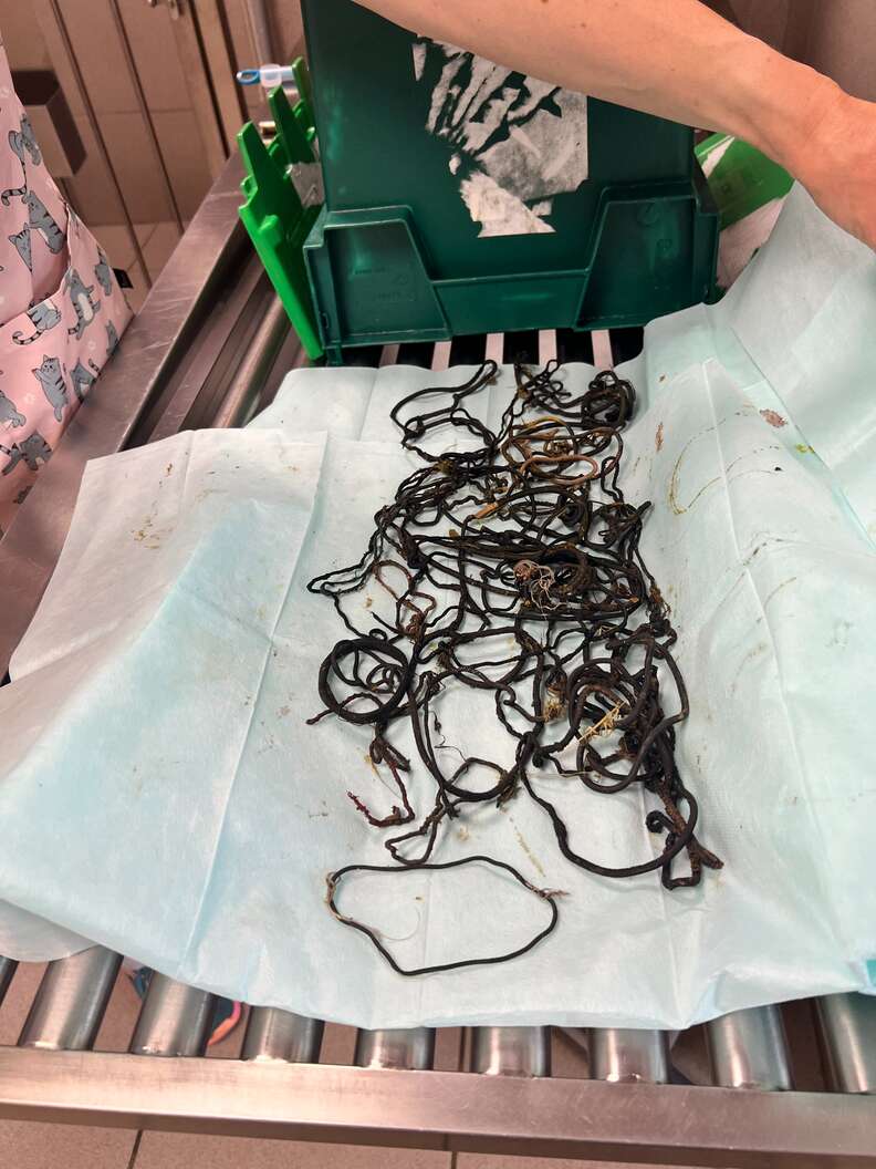 Un enchevêtrement d'élastiques noirs étalé sur un champ chirurgical bleu